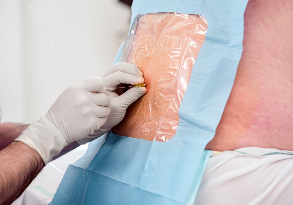 Epidural doğum planlayan hamile kadın, doğuma hazırlık eğitimi hakkında bilgi alıyor.