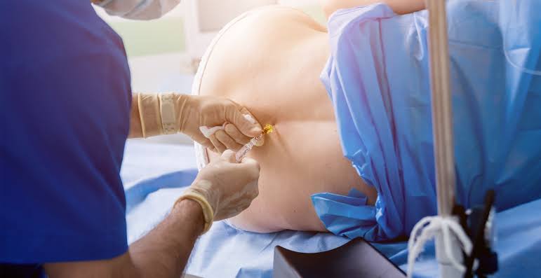 Doğum öncesi doktoruyla epidural doğum hakkında konuşan hamile kadın.